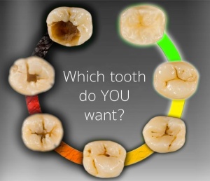 which tooth